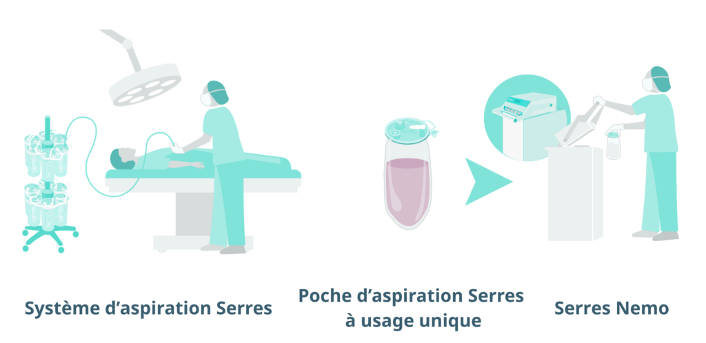 Flux de travail du système d'aspiration Serres et Serres Nemo